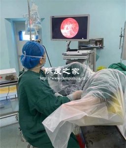 宫腔镜检查后能喝陈皮水吗