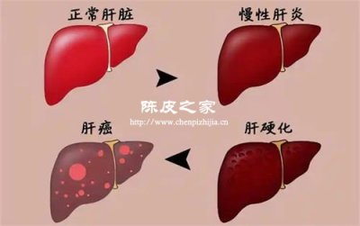 陈皮提取物在酒精性肝损伤修复中的潜力