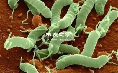 科学家发现陈皮竟能抑制这类病菌